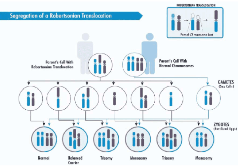 Segregación de translocación robertsoniana